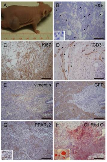 J Cancer Image