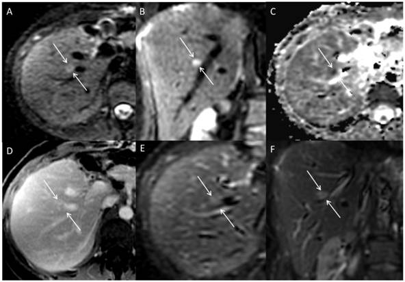 J Cancer Image