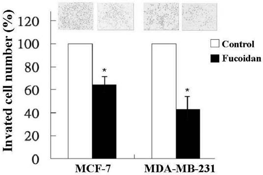 J Cancer Image