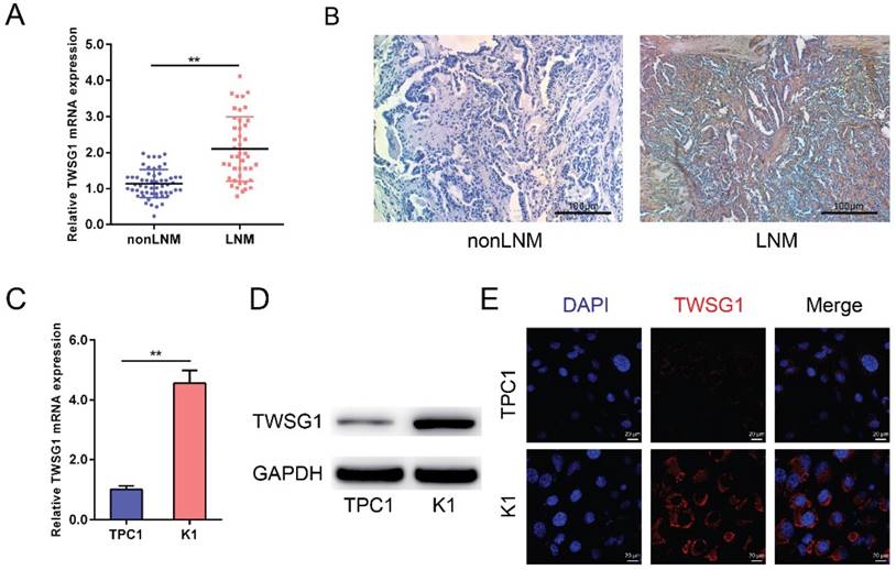 J Cancer Image