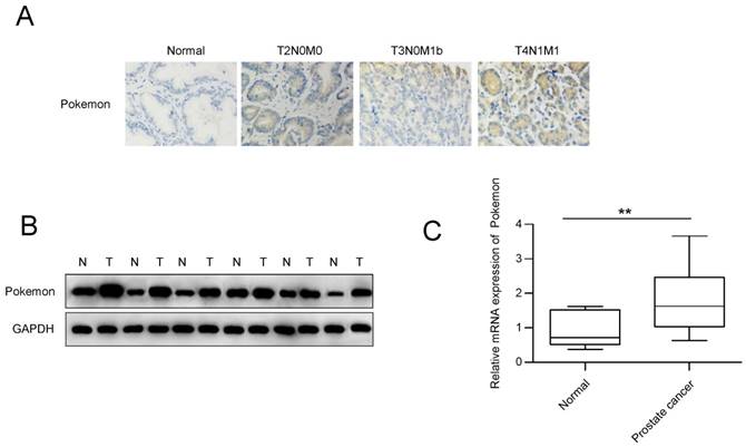 J Cancer Image