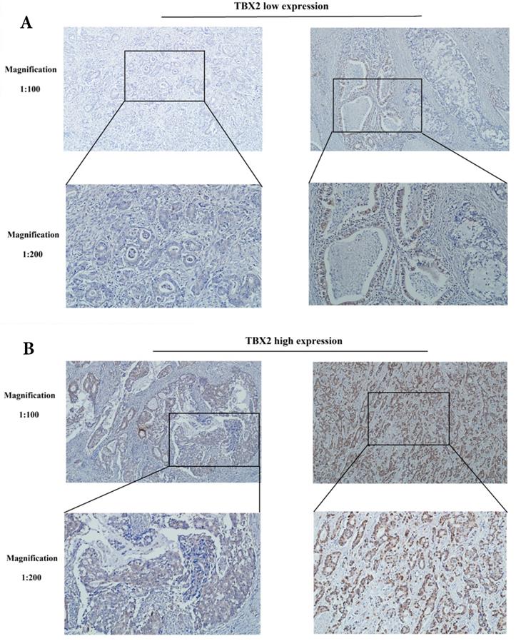 J Cancer Image