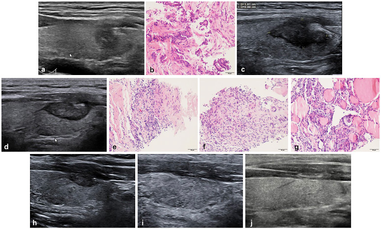 J Cancer Image