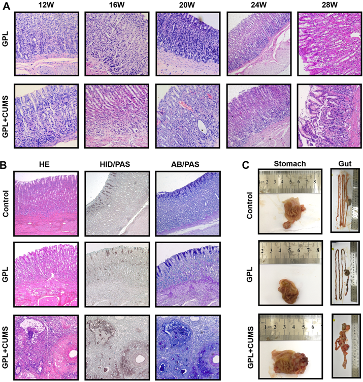 J Cancer Image