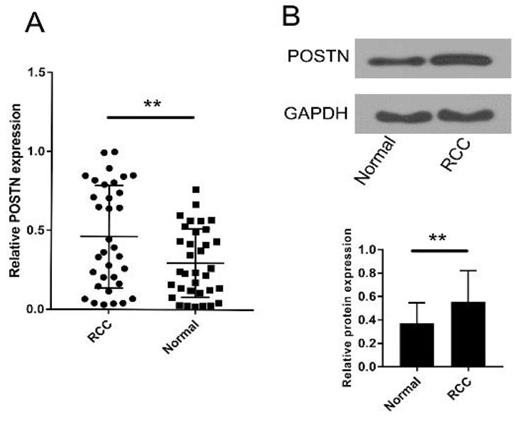 J Cancer Image