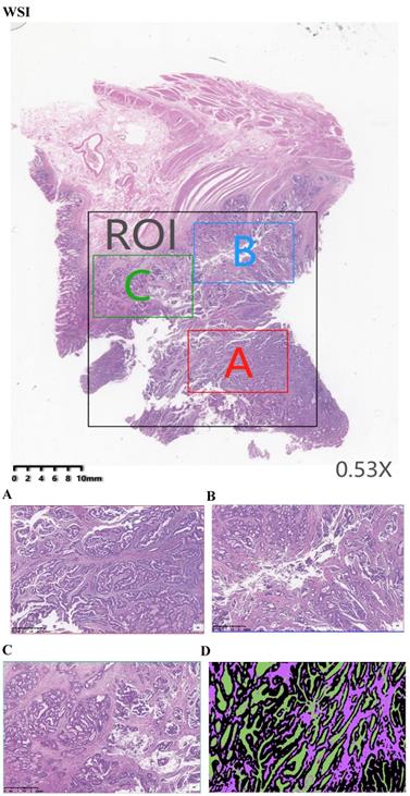 J Cancer Image