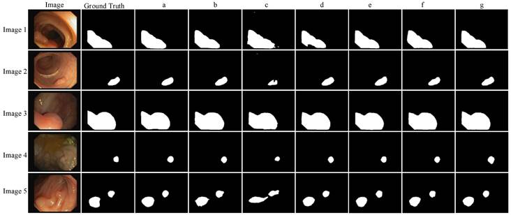 Lightweight Colon Polyp Segmentation Algorithm Based On Improved Deeplabv3