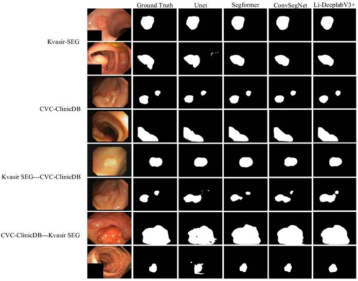 Lightweight Colon Polyp Segmentation Algorithm Based On Improved Deeplabv3