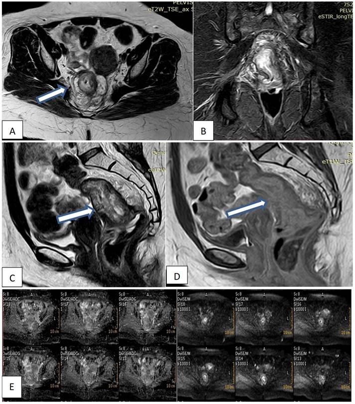 J Cancer Image