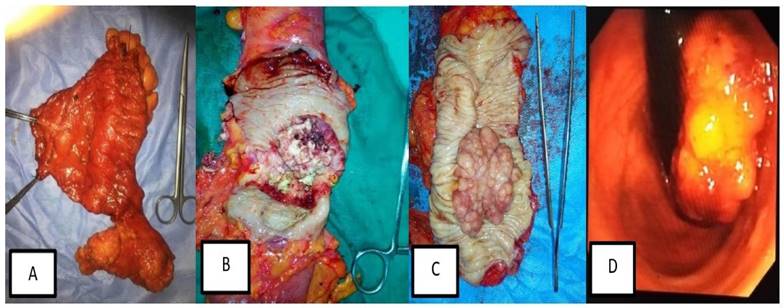 J Cancer Image