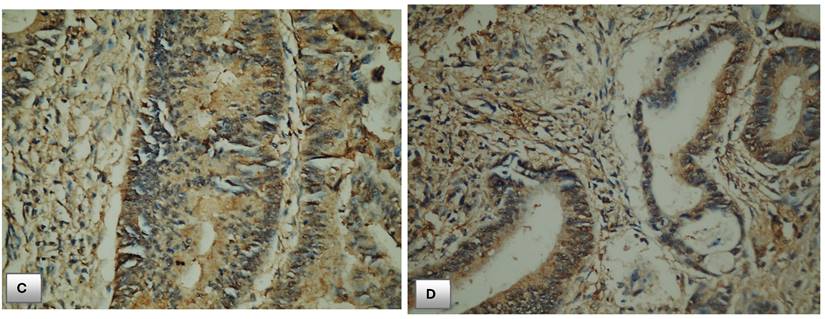 J Cancer Image