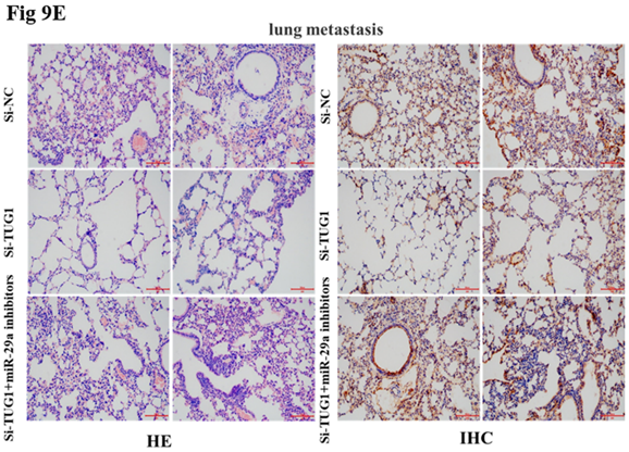 J Cancer Image