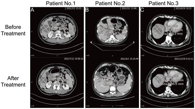 J Cancer Image