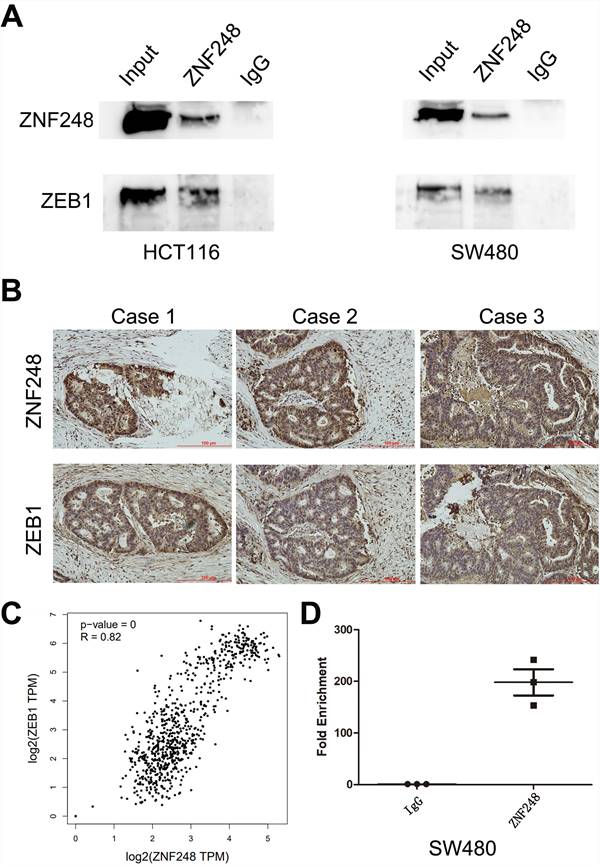 J Cancer Image