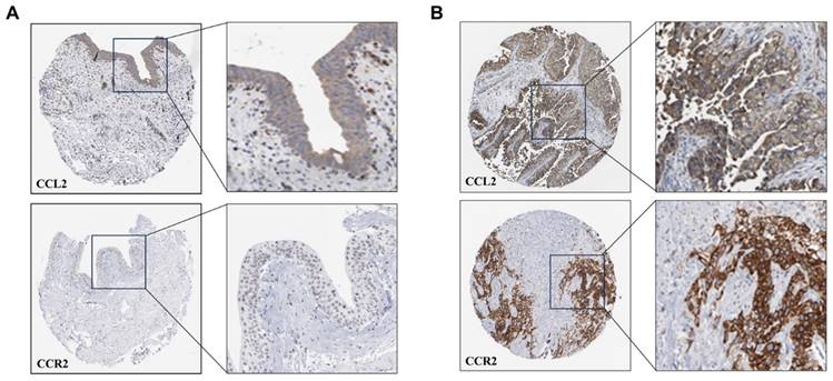 J Cancer Image