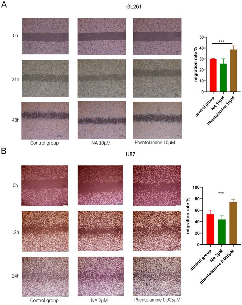 J Cancer Image