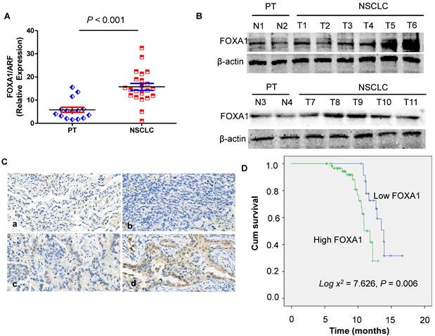 J Cancer Image