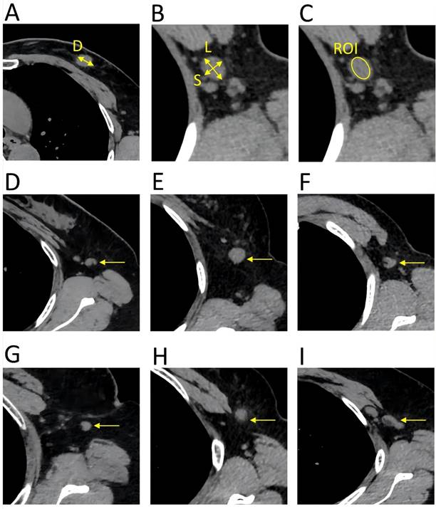 J Cancer Image