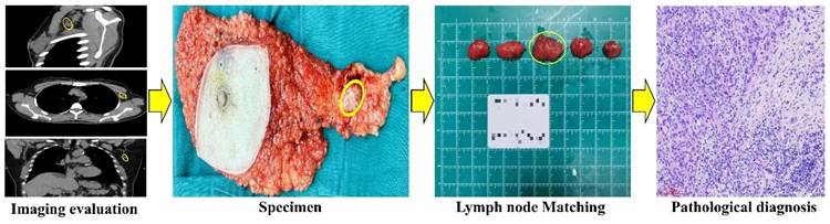 J Cancer Image