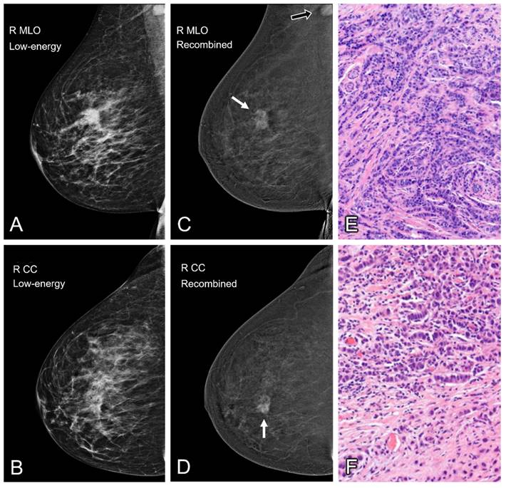 J Cancer Image