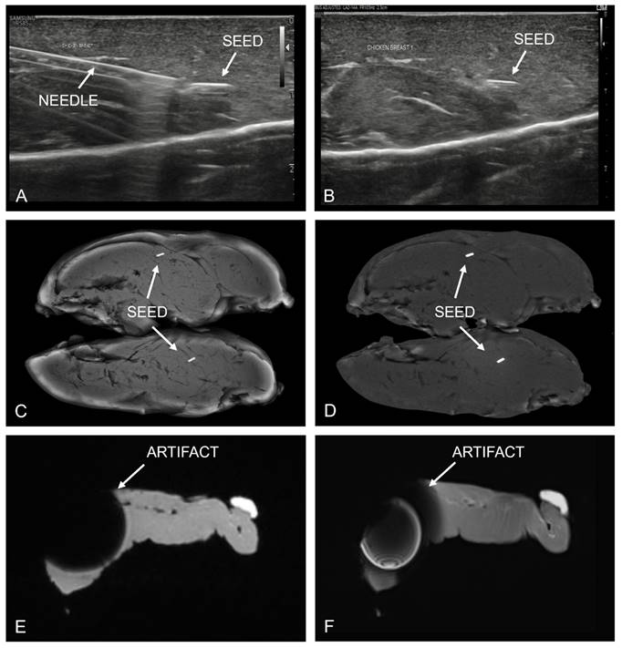 J Cancer Image