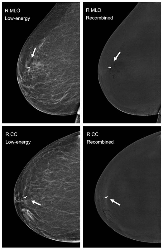 J Cancer Image