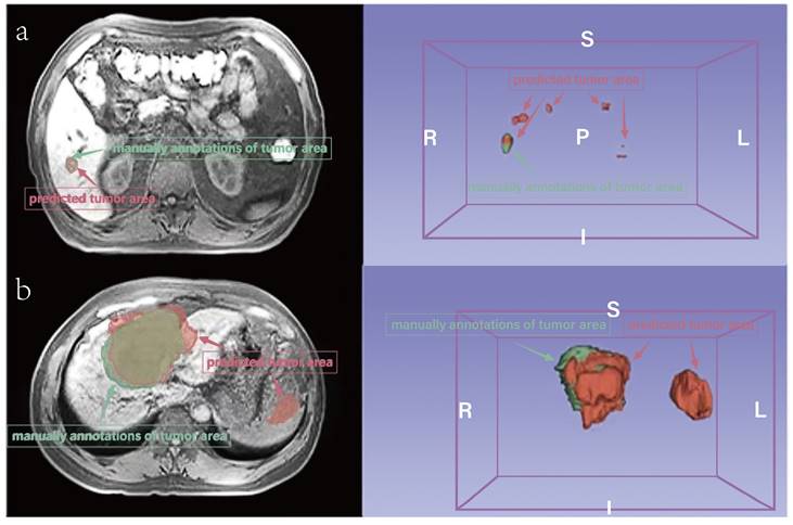 J Cancer Image