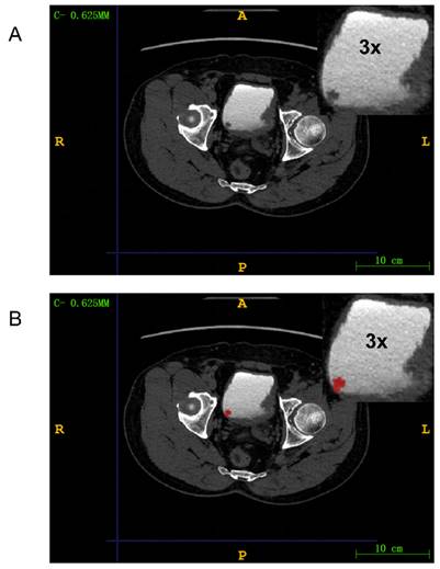 J Cancer Image