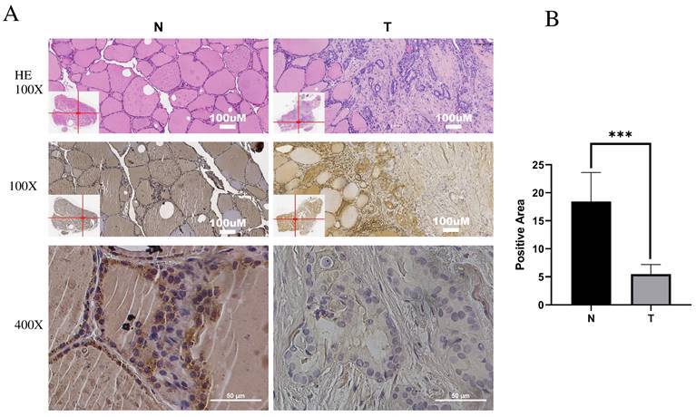 J Cancer Image