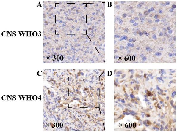 J Cancer Image