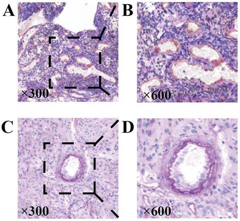 J Cancer Image