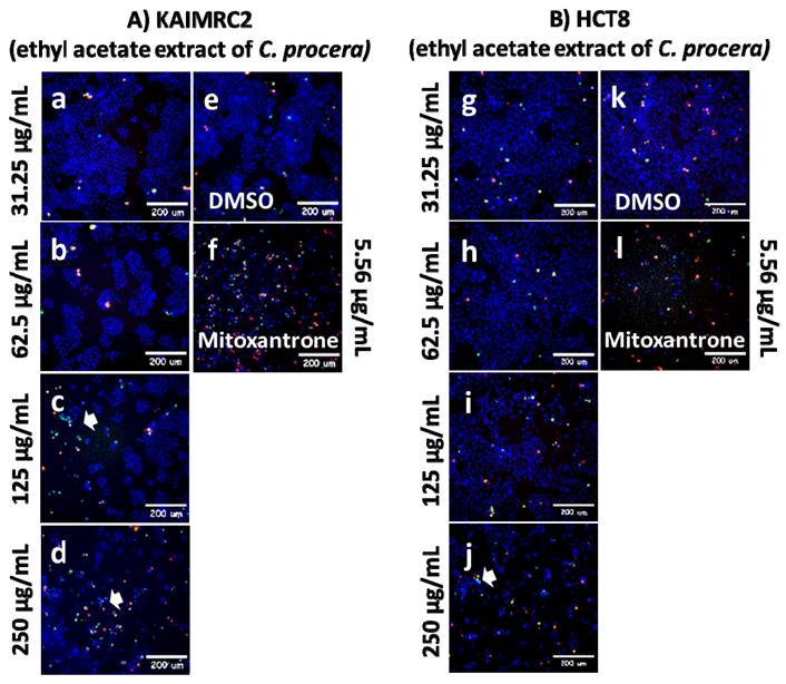 J Cancer Image