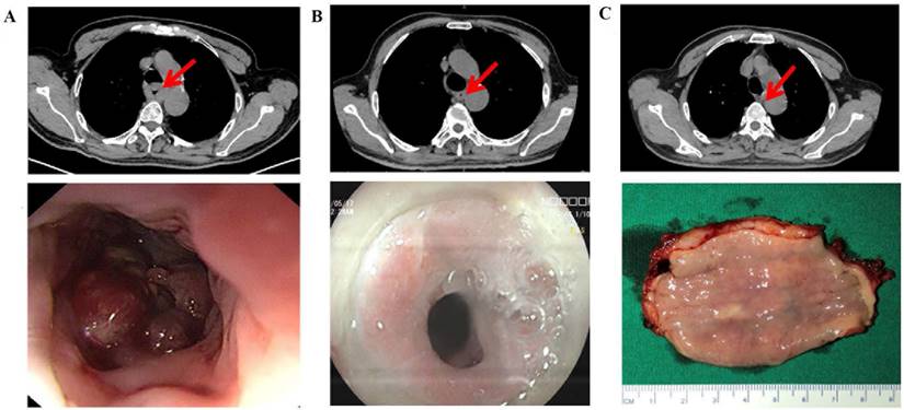 J Cancer Image