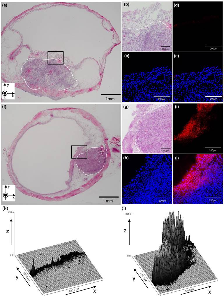 J Cancer Image