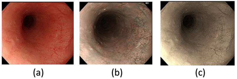 J Cancer Image