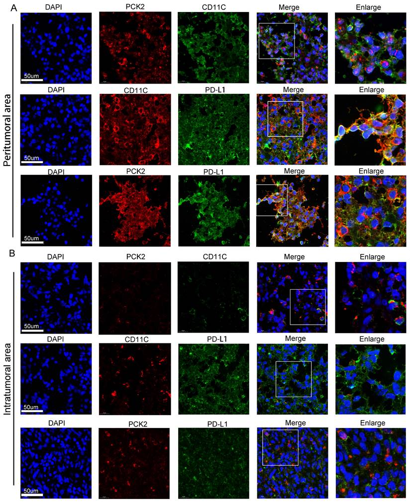 J Cancer Image