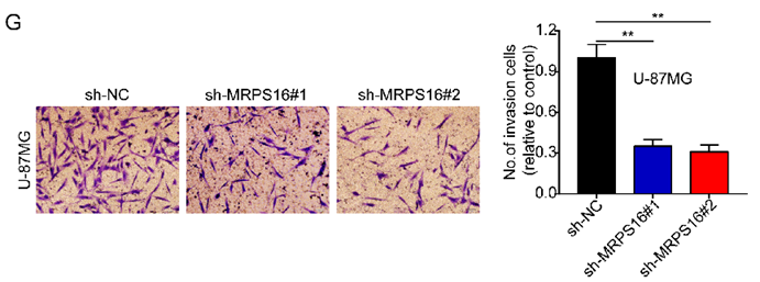 J Cancer Image