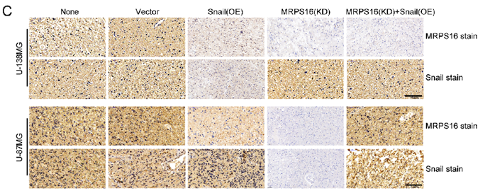 J Cancer Image