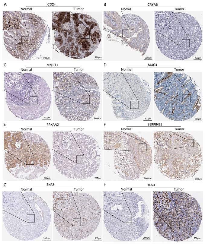 J Cancer Image