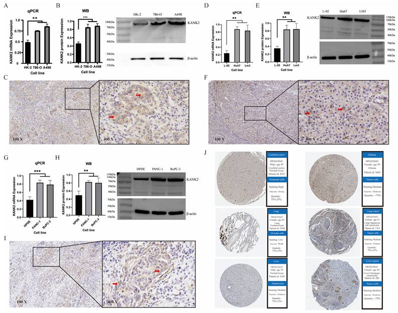 J Cancer Image