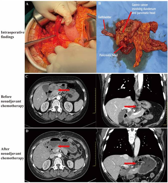 J Cancer Image