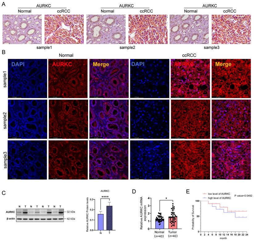 J Cancer Image