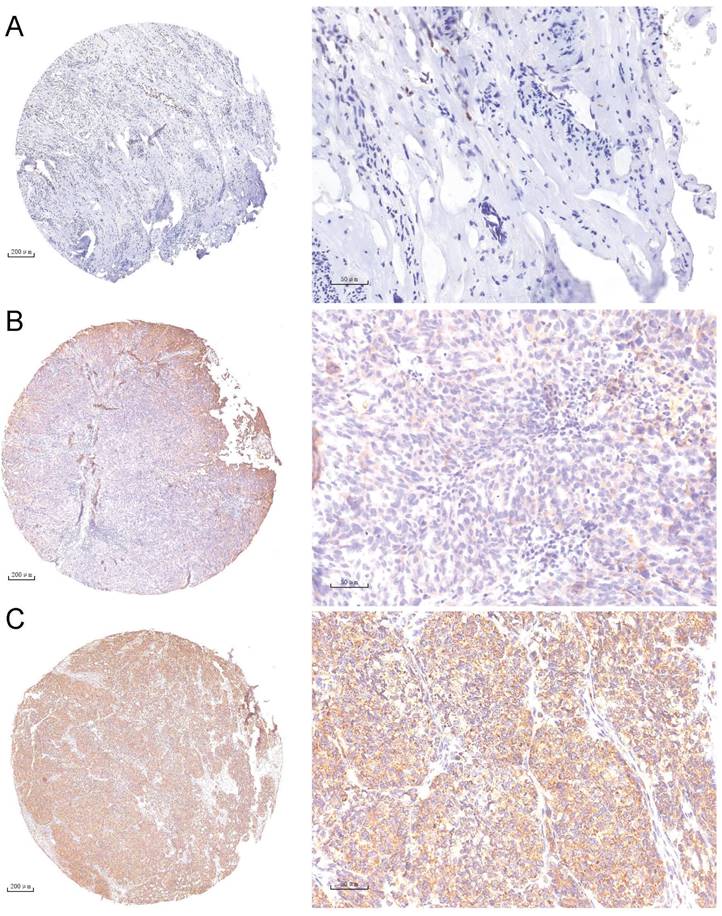 J Cancer Image