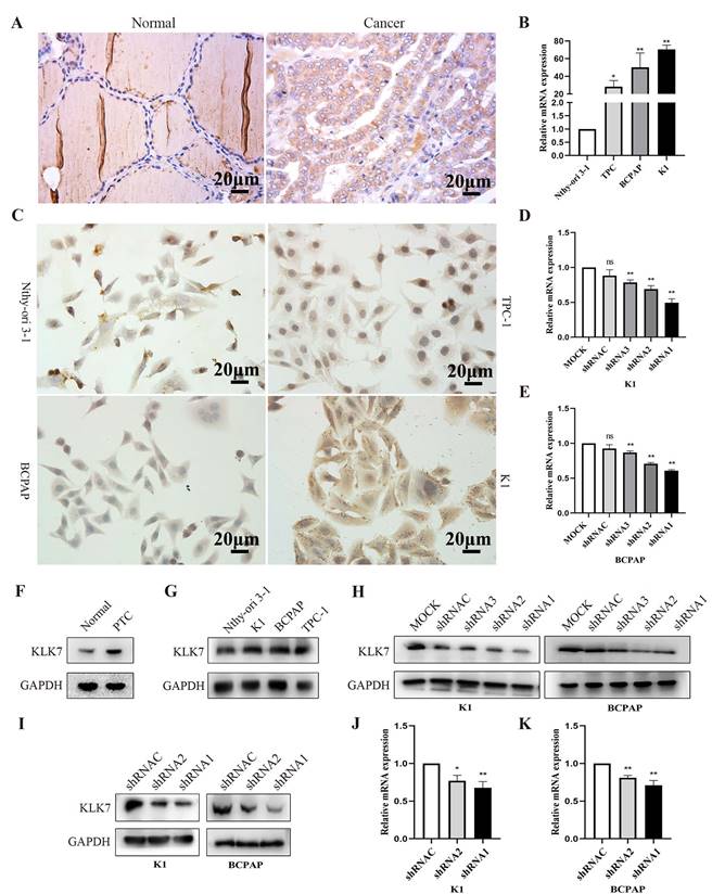 J Cancer Image