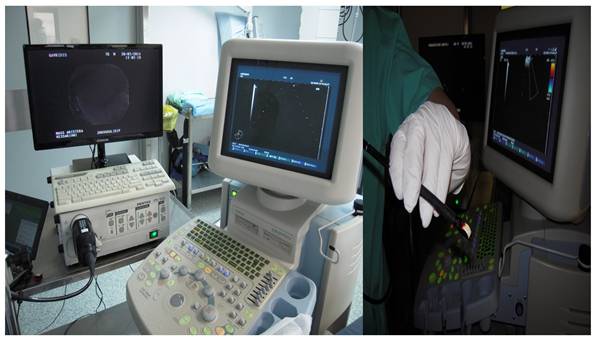 J Cancer Image