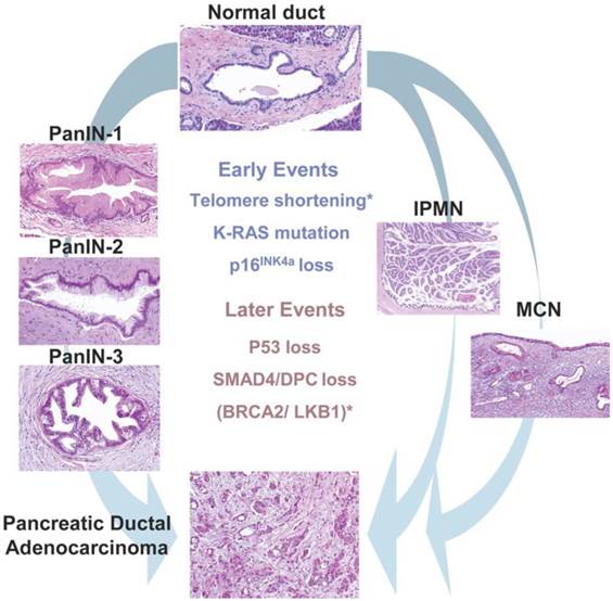 Cancer of the Pancreas: Molecular Pathways and Current Advancement in ...