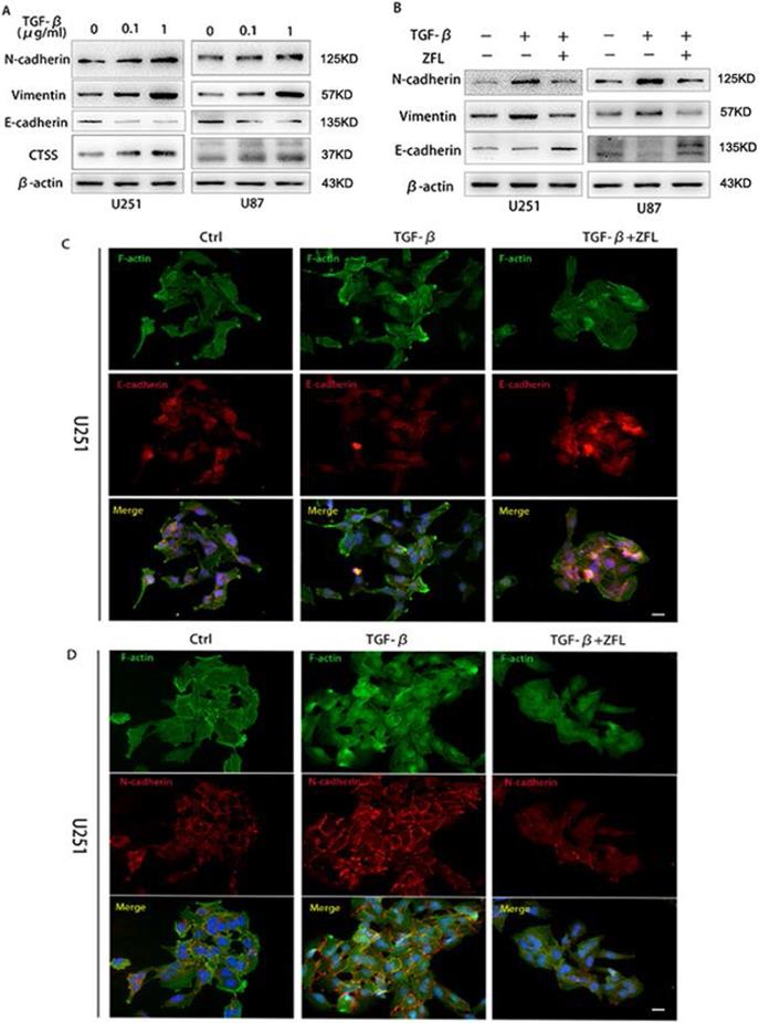 Inhibition Of Cathepsin S Restores Tgf B Induced Epithelial To Mesenchymal Transition And Tight Junction Turnover In Glioblastoma Cells