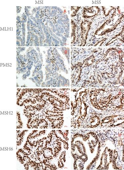 J Cancer Image
