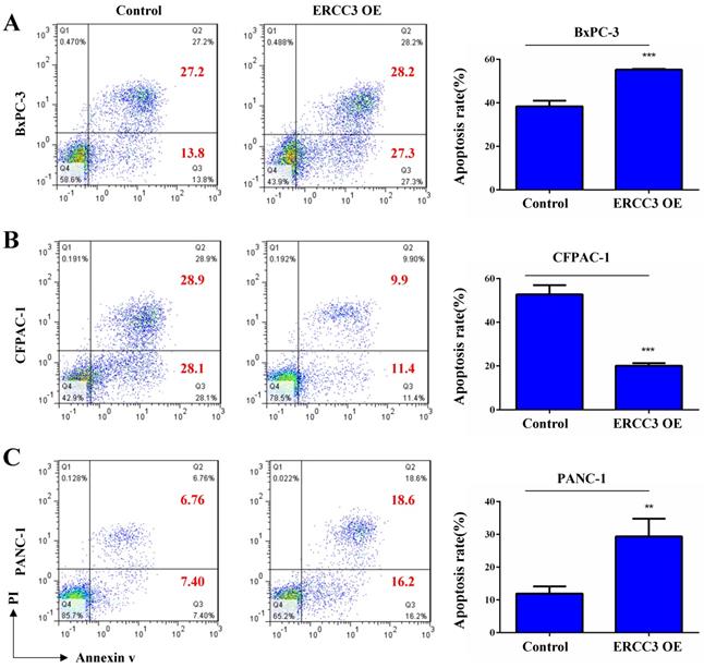 Overexpression of ERCC3 is associated with poor prognosis in patients ...