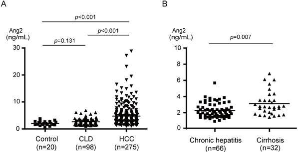 Serum Angiopoietin 2 Acts As A Diagnostic And Prognostic Biomarker In Hepatocellular Carcinoma